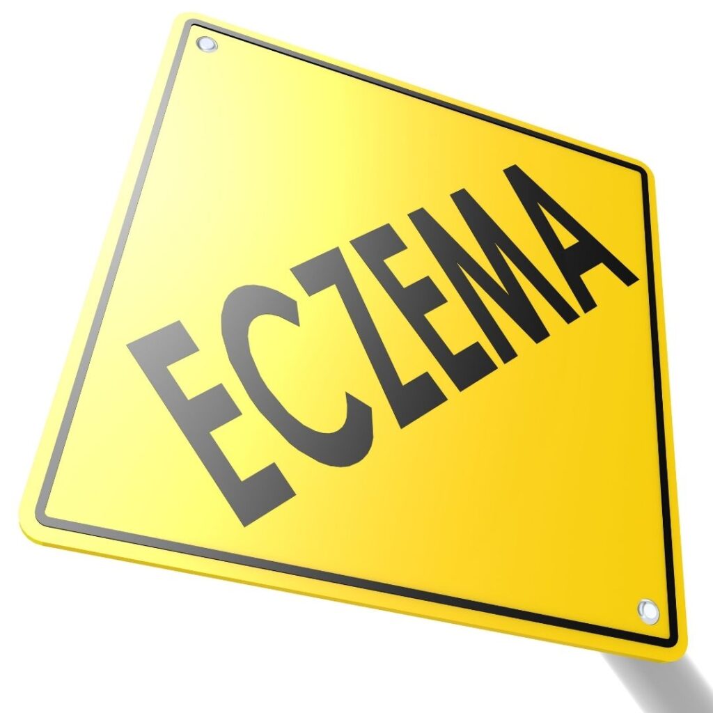 Eczema Sign
